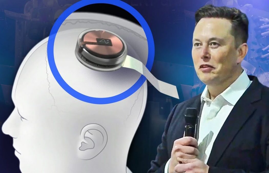 elonmuskmicrocip