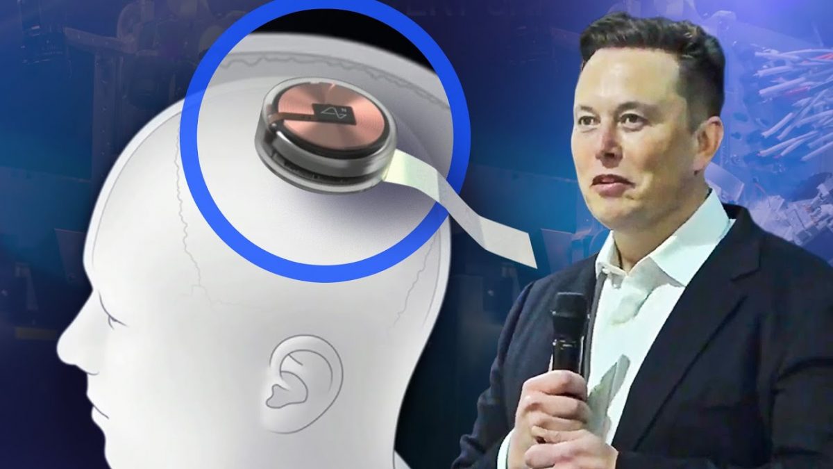 elonmuskmicrocip